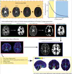 The Spatial Patterns and Determinants of Cerebrospinal Fluid Circulation in the Human Brain