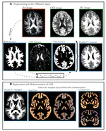 Functional Consequences of Neurite Orientation Dispersion and Density in Humans across the Adult Lifespan