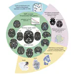 Neurodevelopmental patterns of early postnatal white matter maturation represent distinct underlying microstructure and histology